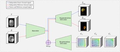 Deep Learning-Based Concurrent Brain Registration and Tumor Segmentation